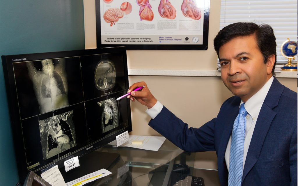 Cardiothoracic Surgeon, Sanjay P. Tripathi, M.D.