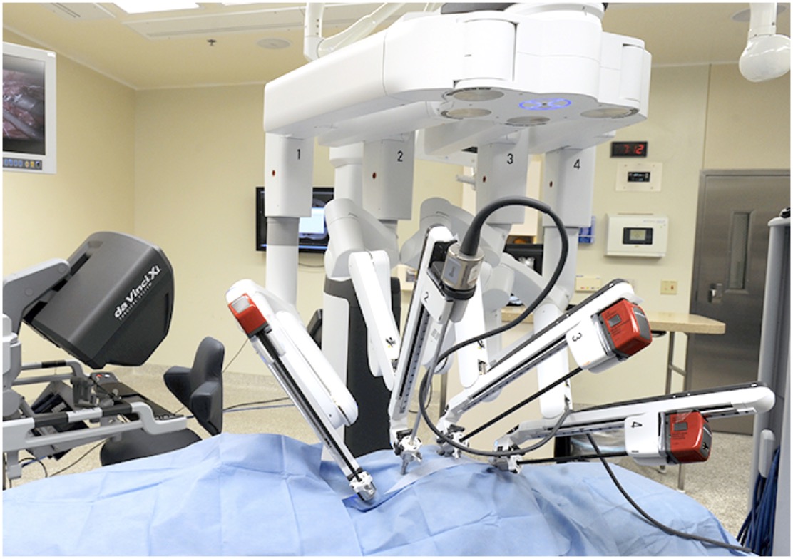 Удаление простаты роботом. Хирургический робот DAVINCI. Роботизированная система да Винчи. Робот-хирург da Vinci (да Винчи). Робот-ассистированная хирургическая система «da Vinci».