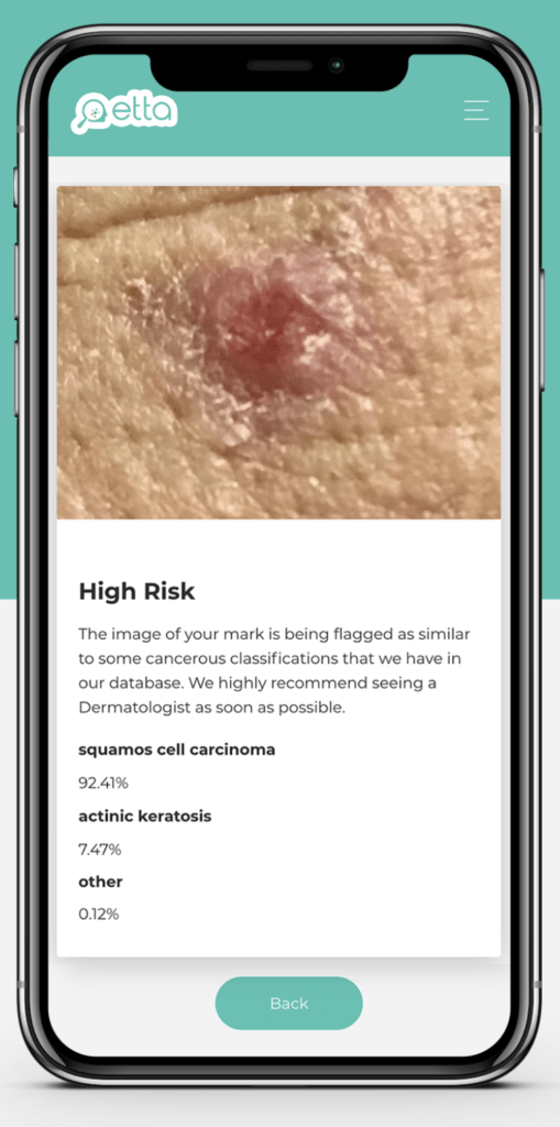 Etta Epidermis, upload image of your skin