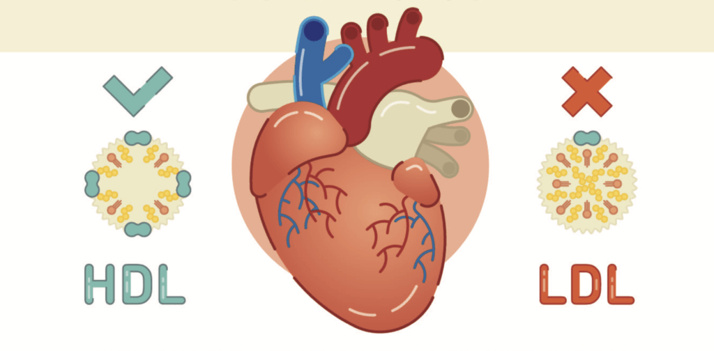 cholesterol screening